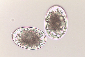 Mikroskopische Aufnahme von Spulwurmeiern.